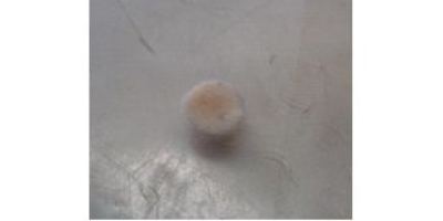 Уплотнение